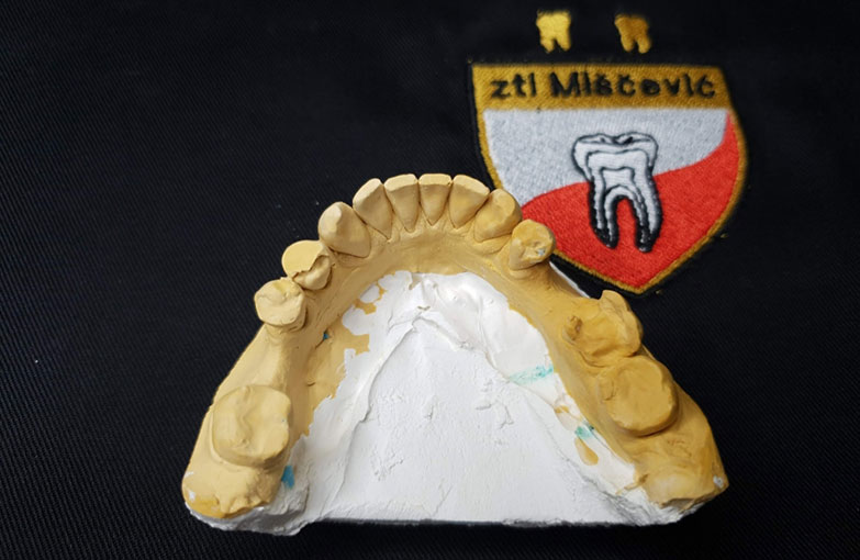 Zubna tehnika - Keramički Inlej | Beograd